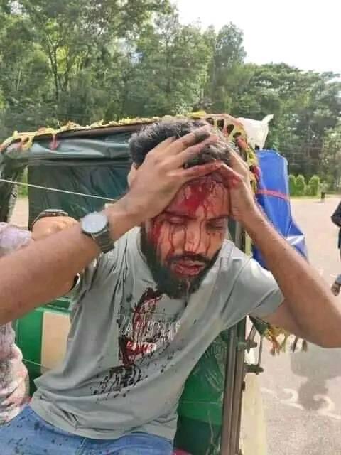 AbdulGafferSiam's tweet photo. This is what happening in Bangladesh right now by the government and armed forces.

#Bangladesh #StudentProtest #SaveBangladeshiStudents https://t.co/kbwulVksgq