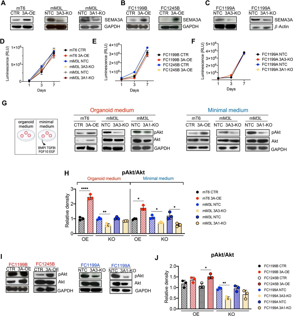 Gut Journal (@gut_bmj) on Twitter photo #GUTImage on the paper by Lupo et al on
"Axon guidance cue SEMA3A promotes the aggressive phenotype of basal-like PDAC" via
bit.ly/4bJJbRT
<a href="/michele_bevere/">Michele Bevere</a> <a href="/SilviaAndreani7/">Silvia</a> <a href="/FrancescoDS82/">Francesco De Sanctis</a> <a href="/ChangilHwang/">Chang-il Hwang</a> <a href="/StefanoUgel/">Stefano Ugel</a> #PDAC #GUTImage on the paper by Lupo et al on
"Axon guidance cue SEMA3A promotes the aggressive phenotype of basal-like PDAC" via
bit.ly/4bJJbRT
<a href="/michele_bevere/">Michele Bevere</a> <a href="/SilviaAndreani7/">Silvia</a> <a href="/FrancescoDS82/">Francesco De Sanctis</a> <a href="/ChangilHwang/">Chang-il Hwang</a> <a href="/StefanoUgel/">Stefano Ugel</a> #PDAC