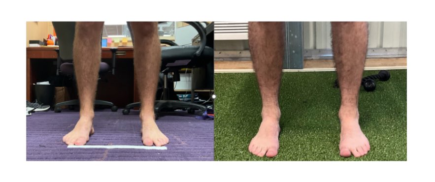 Cool change from fall to spring of rear-foot shape and widening of the mortise of the ankle (look at skinny ankles on left)
Widening allows tibia to actually translate forward 
Look at change in direction of front of ankle in sequence 
Better delay of back side --better timing