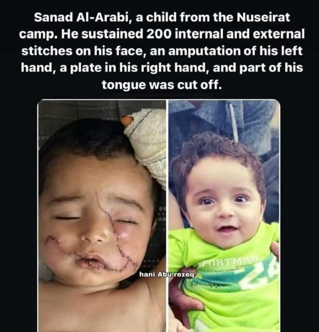TaghridAlMawed's tweet photo. Remember, the genocide started over 76 years ago. This child is neither the first nor the last.e last.
#Neverf #GazaGenocide #Palestine https://t.co/vCXBEdaF6V