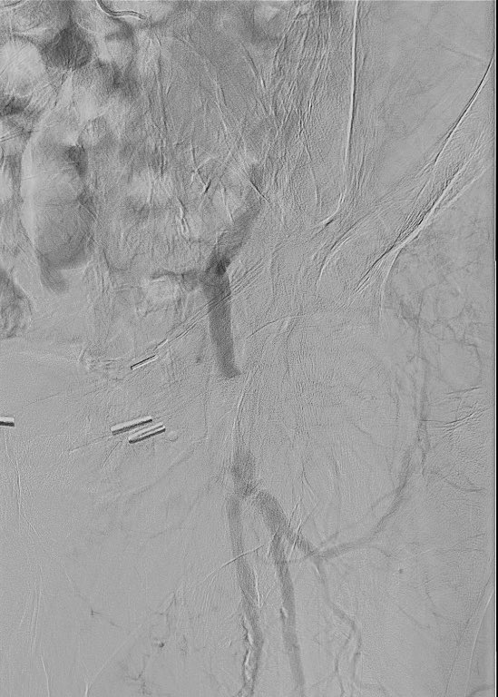 Bilal Aijaz tweet media