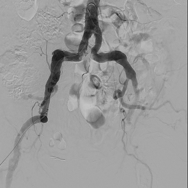 Bilal Aijaz tweet media