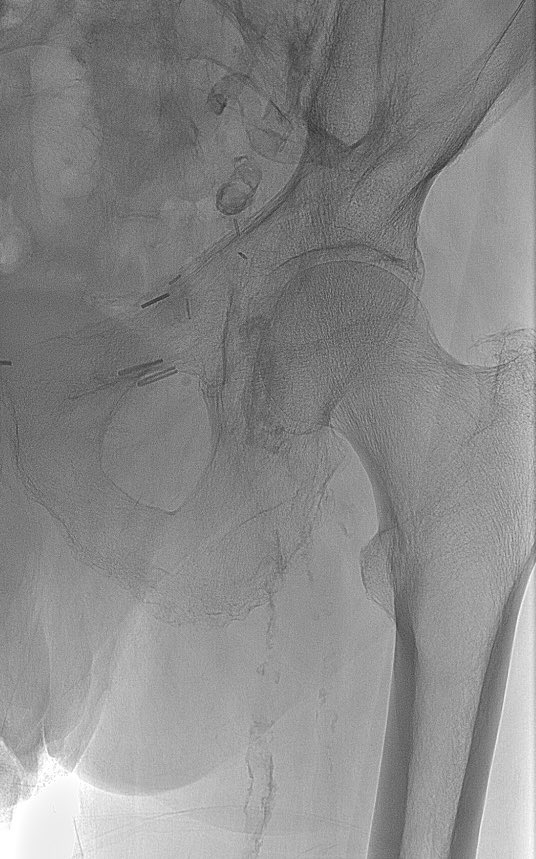 Bilal Aijaz tweet media