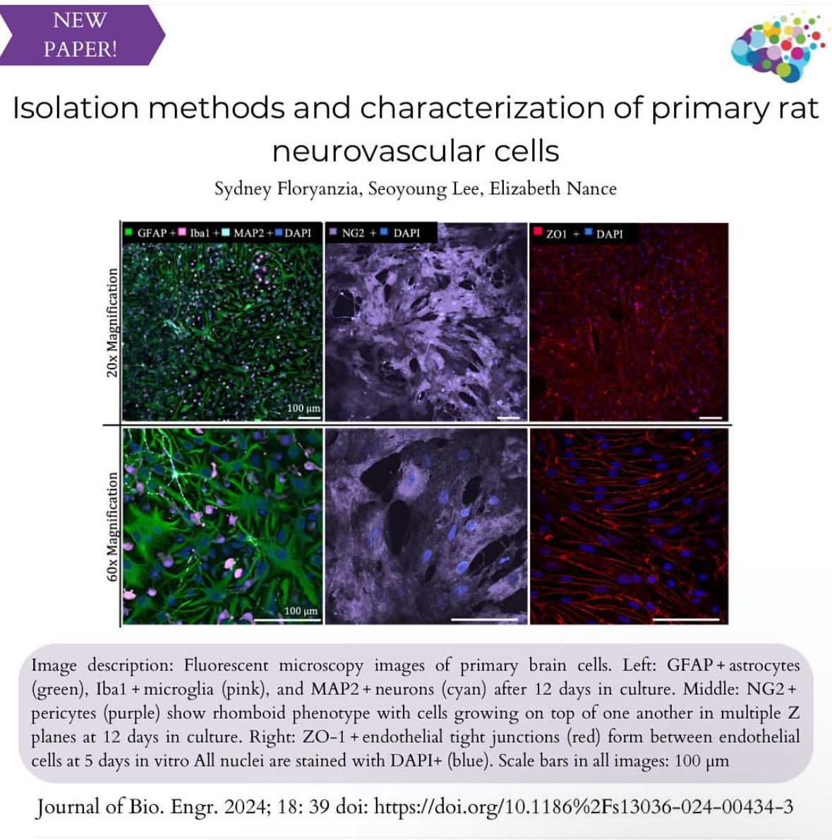neurochemequeen's tweet image. 🌟🚨 New Paper Alert!! 

In this manuscript, we discuss our protocols to isolate primary pericytes, endothelial cells, &amp;amp; astrocyte-dominant glial cultures. 🧵(1/4)

ncbi.nlm.nih.gov/pmc/articles/P…

#bbb #primarycells #nvu #tissueengineering #bloodbrainbarrier #neurovasculature #research