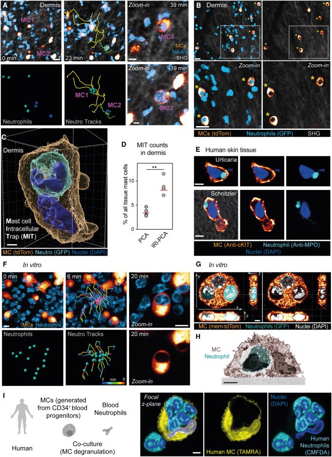 During allergen challenge, degranulating mast cells re-route and trap living neutrophils in vivo, resulting in functional and metabolic alteration of the mast cell and the acquisition of neutrophilic features <a href="/CellCellPress/">Cell</a> @Lammermann_Lab
cell.com/cell/fulltext/…
