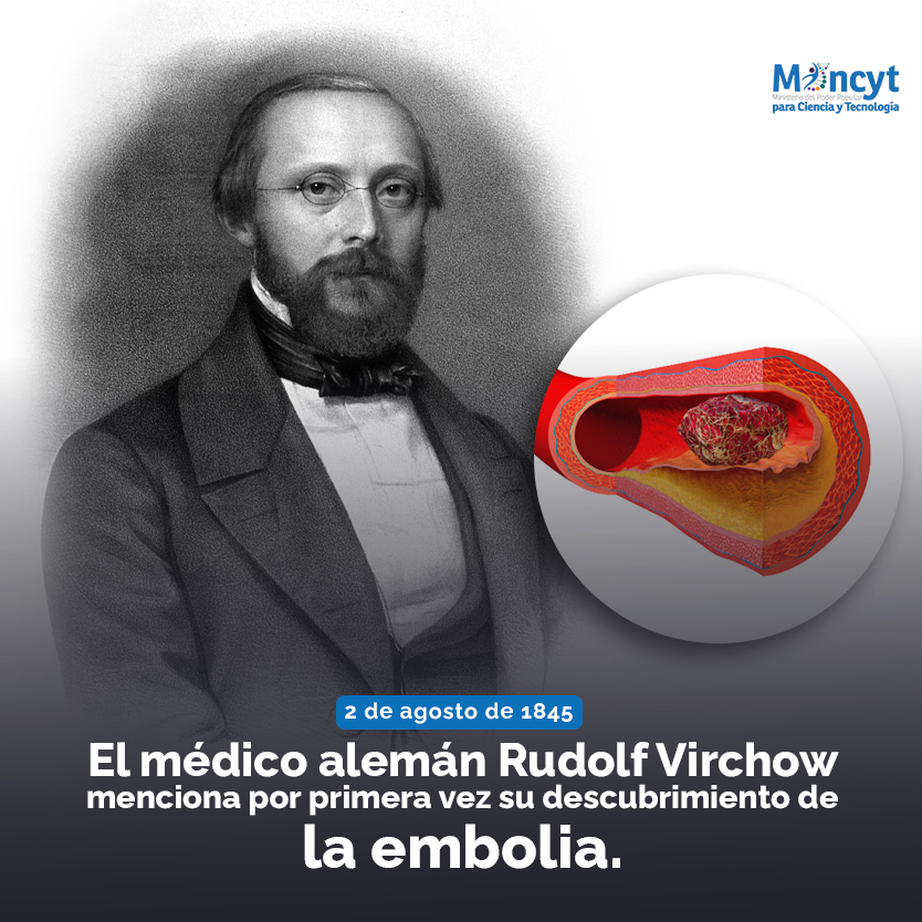 Mincyt_VE's tweet photo. #Efemérides | #2Ago El médico alemán, Rudolf Virchow, menciona por primera vez su descubrimiento de la embolia. 

#MujeresPorLaPaz https://t.co/b25pWGSOmf