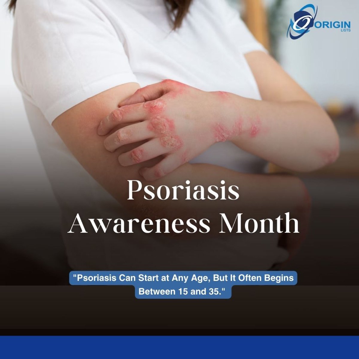 OriginLists's tweet image. Let’s unite in raising awareness about psoriasis and engage in daily habits that benefit our healthier skin. ✊🤝
#psoriasisawarenessmonth #psoriasisawarenessmonth  #psoriaticarthritis
#psoriasiswarrior #psoriasisawareness #psoriasisawarenessweek