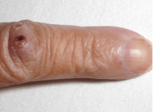 MRCEM Success tweet media