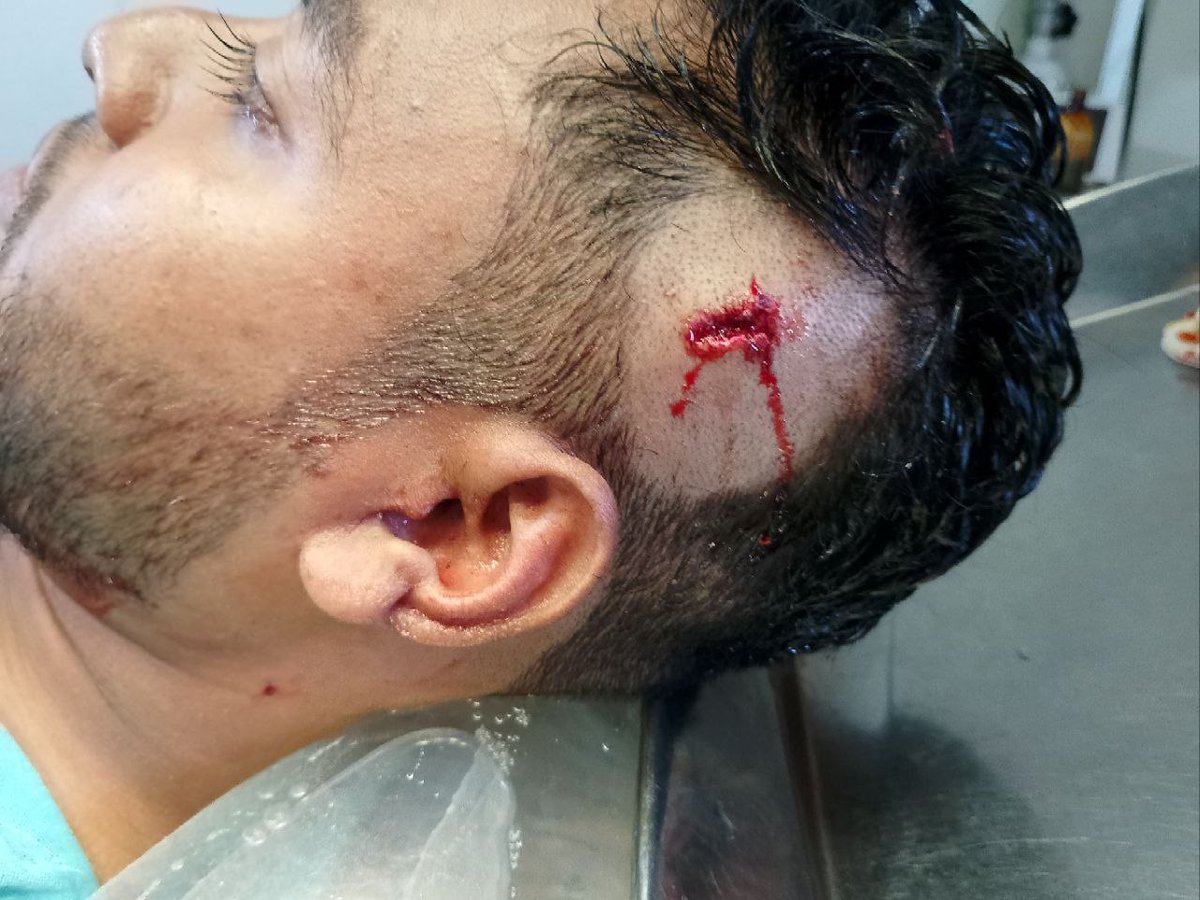 mrsabbir55's tweet photo. #StudentsUnderAttack 
#SaveBangladeshiStudents 
#Bangladesh
#JusticeForStudents
#BangladeshBleeding 
#BangladeshiStudentsareinDanger 
#SaveBangladeshiTeachers
#ShameOnBDPolice
Students under attack on Uttara, Sylhet, Khulna, Habiganj, Tangail area. https://t.co/ec8TEKuo5H