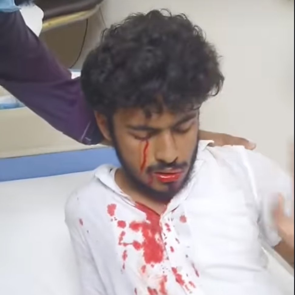 taefza's tweet photo. 🚨 Tahmid, Student of Independent University,has been shot at his eye
📍Uttara
STEP DOWN FASCIST HASINA 
#StepDownHasina 
#StepDownHasina #StudentsUnderAttack #SaveBangladeshiStudents #BangladeshiStudentsareinDanger #BangladeshBleeding https://t.co/UfpkWRODpp