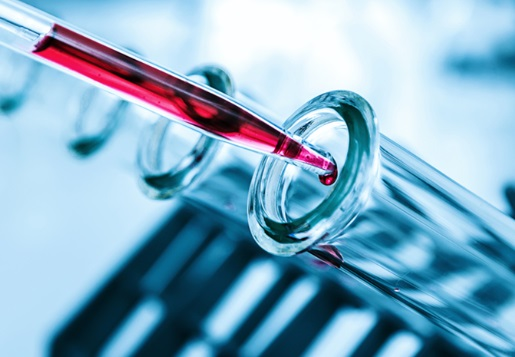 DatelineHealthA's tweet photo. Remember, 'Prevention is the best medicine'? 

Based on a study, UK researchers can predict risk of 200+ diseases with a single drop of blood! 

Early detection = earlier treatment = better survival rates. 

Read more: https://t.co/ozsLMqtxob

 #healthcareafrica  #Prevention https://t.co/F138SvCuwv
