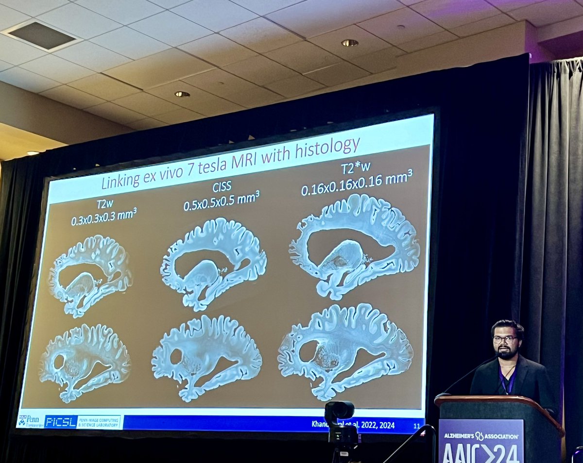Dr. Laura Jonkman (@neurolaura) on Twitter photo Off to a fantastic start at 8am on a Wednesday morning! Three talks on in-vivo MTL volume differences in different #FTD subtypes, on path hallmarks and #amygdala volume, and on 7T segmentation methods for quantitative analysis. #AAIC2024 @lemwisse <a href="/pulkittweet/">Pulkit Khandelwal</a> Off to a fantastic start at 8am on a Wednesday morning! Three talks on in-vivo MTL volume differences in different #FTD subtypes, on path hallmarks and #amygdala volume, and on 7T segmentation methods for quantitative analysis. #AAIC2024 @lemwisse <a href="/pulkittweet/">Pulkit Khandelwal</a>