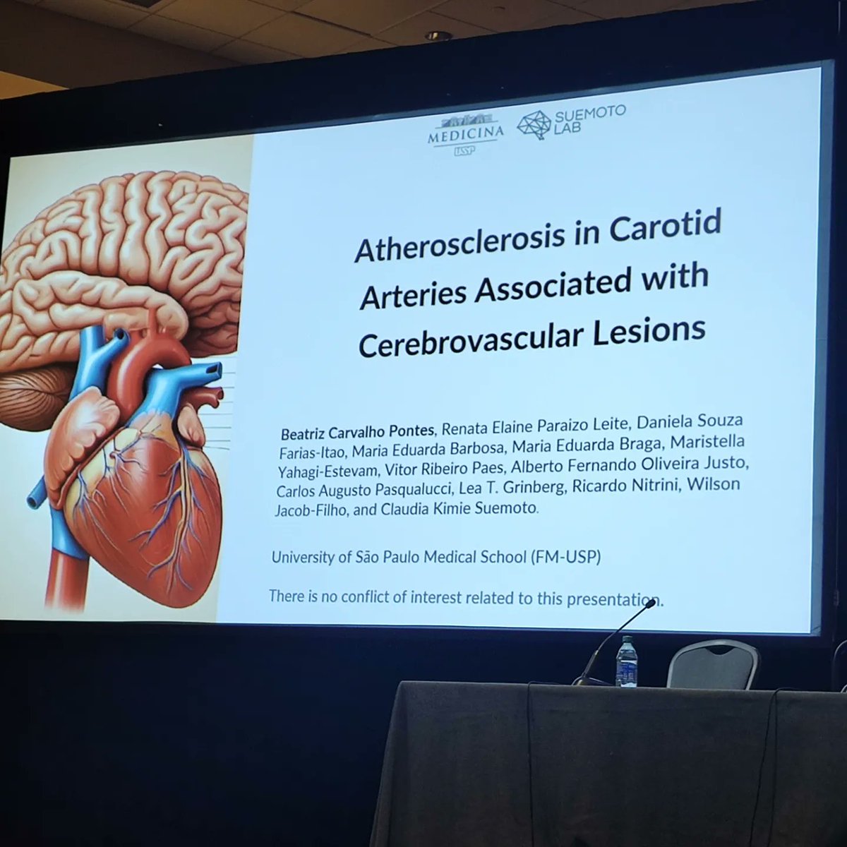 clausuemoto's tweet photo. @BCarvalhoPontes presented her results on the association between carotid artery atherosclerosis and cerebrovascular lesions. We analyzed atheroma plaque size and composition in 2,300 arterial segments. Lacunar infarcts and arteriolosclerosis related to atherosclerosis.#AAIC24 https://t.co/PxitcgAFDt