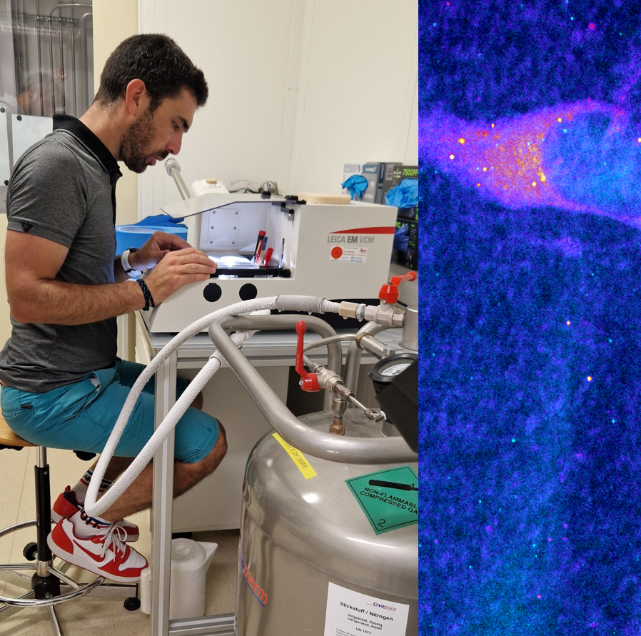 Alexandra Pacureanu (@apacureanu) on Twitter photo Last experiment for this summer <a href="/esrfsynchrotron/">European Synchrotron</a> <a href="/id16a/">ID16A@ESRF</a> with help from #cryo wizard <a href="/benoitgallet/">Benoit Gallet</a> 🧠❄️
The meditation session before proceeding to the Olympic level precision sample transfer😌 Last experiment for this summer <a href="/esrfsynchrotron/">European Synchrotron</a> <a href="/id16a/">ID16A@ESRF</a> with help from #cryo wizard <a href="/benoitgallet/">Benoit Gallet</a> 🧠❄️
The meditation session before proceeding to the Olympic level precision sample transfer😌