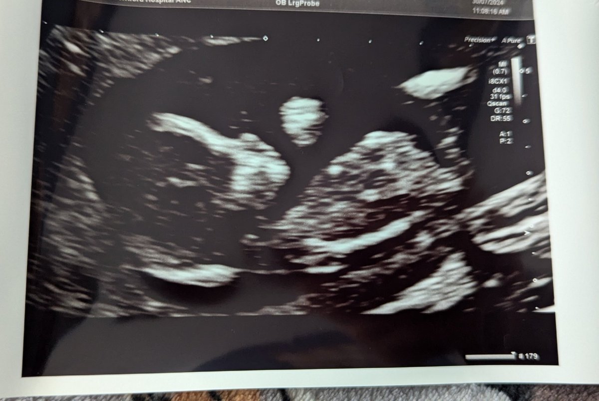 supersophz's tweet photo. Me and @Arcanam8 are expecting a little gamer baby due 5th Feb 2025 👶🏼🍼🎮🥰 https://t.co/k7Anuqpd61