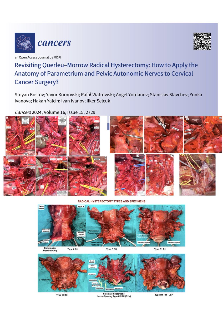 ilkerselcukmd's tweet photo. A great honor. Re-defining the concept of parametrial anatomy, nerve sparing and radical hysterectomy types with our international team of gynecological oncologists and anatomists. 'Radical hysterectomy is the art of pelvic surgery, Ilker Selcuk MD-PhD' @IJGConline @ESGO_society https://t.co/3kjkS1RKRq