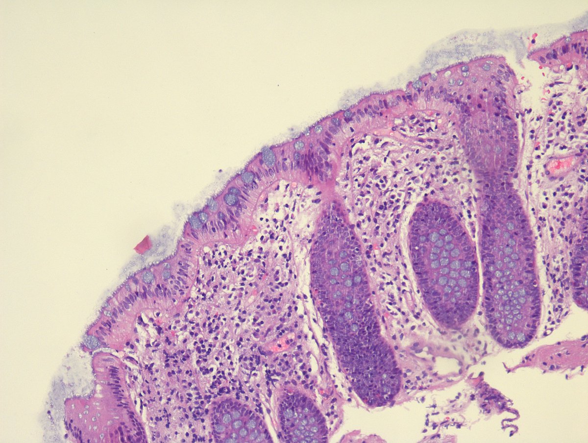 Miruna Popescu, MD tweet media