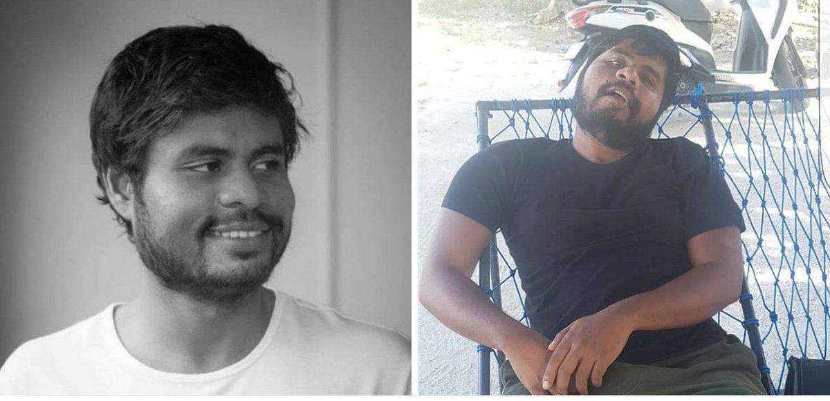 HKurusee's tweet photo. Do you remember him? His nickname is Otto I think.

I don’t know him personally. But I remember his case. He’s a well educated man, from UK or Australia, was going somewhere on a motorcycle in Hulhumale’ when an out of control thug hit him, disabled him for life. He has a wife and a kid too.

Will he ever get his previous life back?

Did he get any compensation for this? 

Did he get justice?

My advice is, don’t trust the Police would do any proper road policing. Don’t trust other road users would follow rules, especially when the gang population is so high. In a failed state like Maldives, you’ll have to protect you and your own family. That includes taking extraordinary care when you’re walking on the road and riding/driving vehicles. Use the mirror properly. Don’t wear headphones when you’re on the street cause you never know which thug is going to run you over from behind so if you’re not wearing headphones you would at least hear vehicles coming and give you may be a second or two to run for your life. Don’t stop on a side of the road even to send a text or answer a call, EVEN IF IT LEGAL. Wear helmet, especially in Hulhumale and on the bridge. Nobody’s going to protect you, remember that. Once you’re disabled, that’s it for you. You won’t get any compensation or justice in Maldives. You’ll realise this when this happens to you or someone you love.