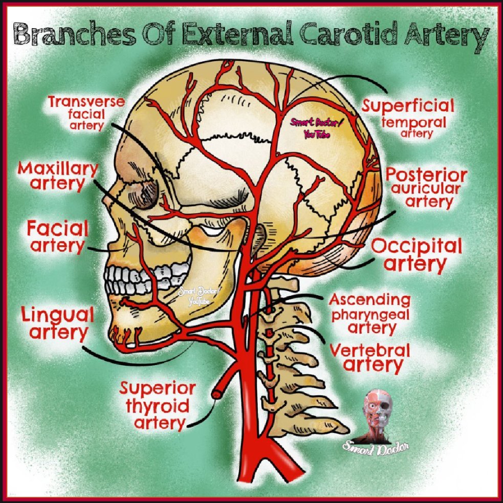 Smart_Doctor1's tweet photo. The external carotid artery can easily be distinguished from the internal carotid artery in the neck because it gives off many branches, while the internal gives off none. A common mnemonic to help remember the branches is👉Some Anatomists Like Freaking Out Poor Medical Students https://t.co/HDj6H5r3hm