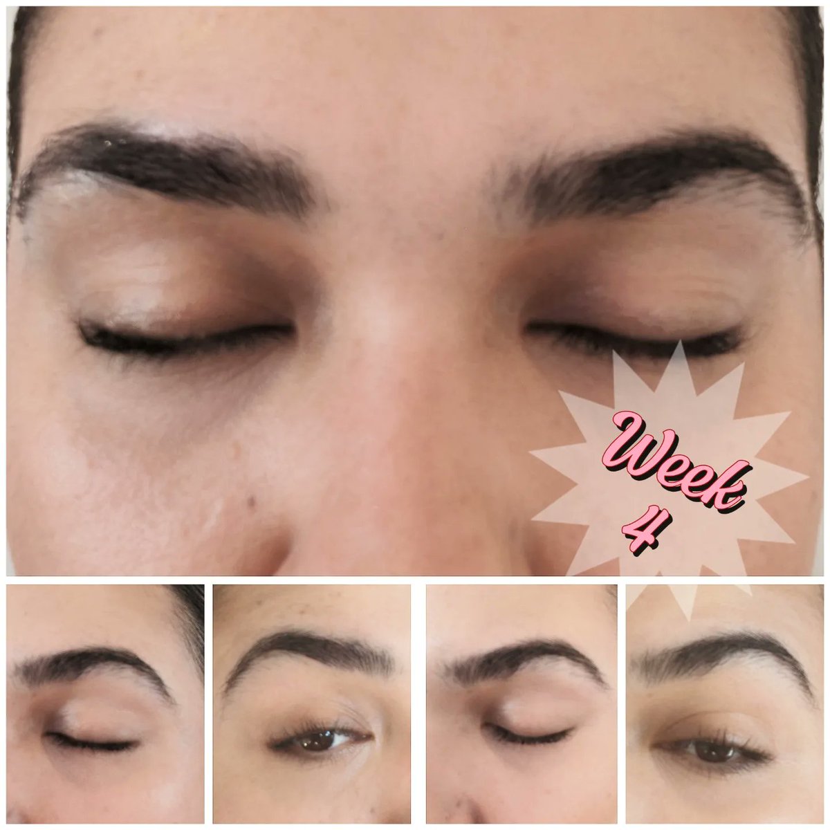TheRadianceRoom's tweet photo. Brow Journey Update - Week 4 &amp; 5 ☑️ Swipe ➡️

As you can see my brows are gradually getting thicker &amp; fuller @TheRadianceRoom

My aim is to grow them out to change their shape👌🏼
#browsonfleek #browjourney #browlamination #browwax #browtint  #beautytreatments #fypage #foryoupage https://t.co/49lK5eFHw6