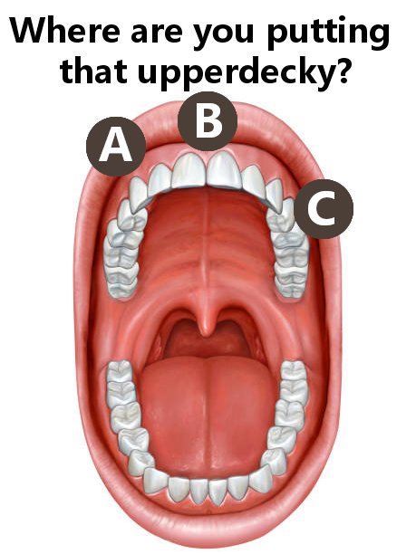 gmradiox's tweet image. Thoughts? #upperdecky