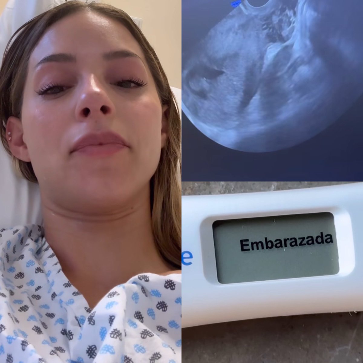 Cerebros tweet media