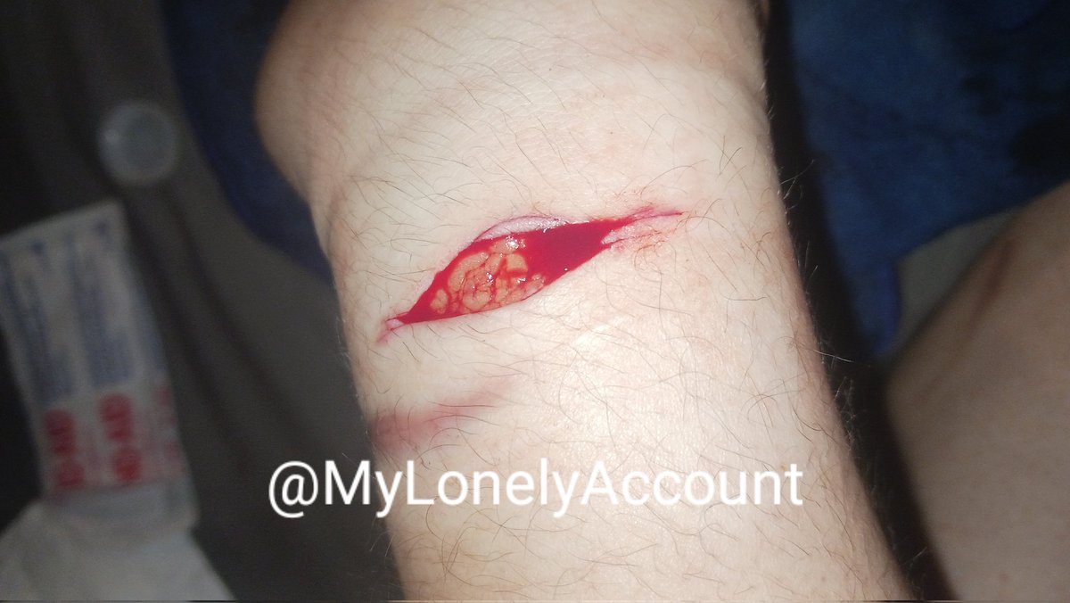 MyLonelyAccount's tweet photo. Back of wrist cut, cute little cut https://t.co/IDbiuZ0kQB