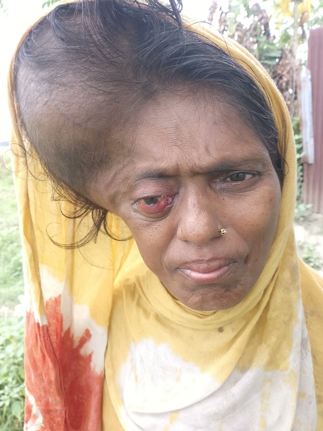 আপনার একটু সহযোগিতায় বাঁচতে পারে তাঁরাবানু