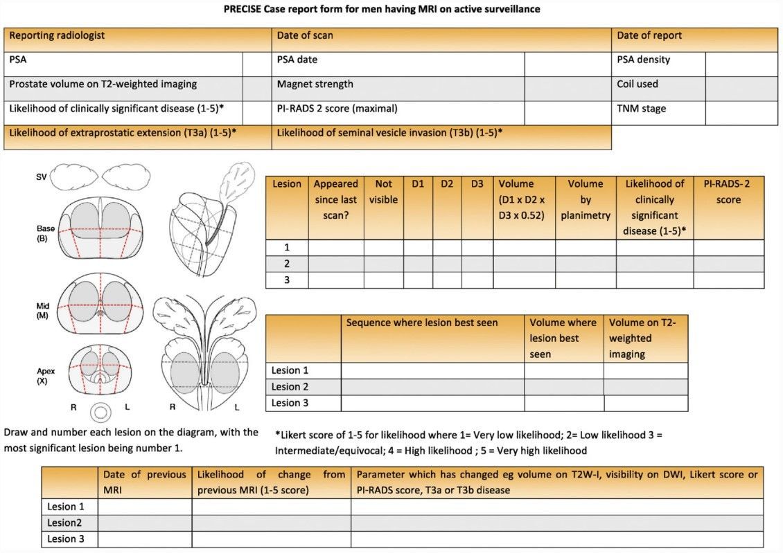 InsightsImaging's tweet image. This study by @giga_fra et al. explores how a dedicated @ESOR_myESR teaching course on the use of the #PRECISE score can improve the accuracy in the assessment of radiological change in multiparametric MRI of the #prostate.

#InsightsIntoImaging

🔗 buff.ly/4cZUO8O
