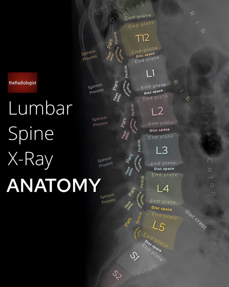 Source:  <a href="/radiologistpage/">theRadiologist</a>