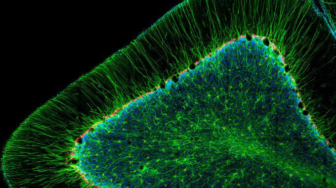 8 octobre 2008 – George E. Palade, biologiste cellulaire roumano ...