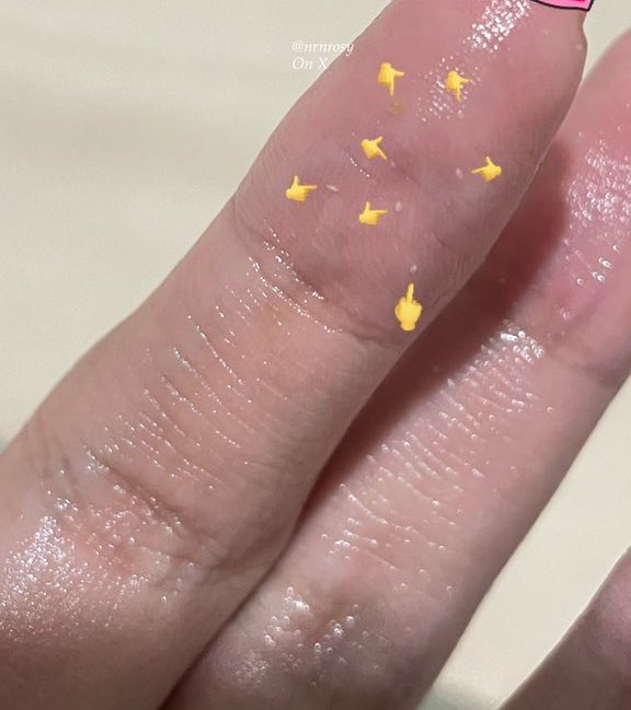 nrosynr's tweet photo. @womanfeeds_id Pake cleansing oil + moistt nya juga!!

Cleansing oil nya BESTTTT, super ringan, aman poll buatku yg acne prone + dia ampuh bgtt angkat komedo (pake teknik oil gritting)☝🏻😭

Moist nya ringan bgtt tpi ttp bikin lembab, cepet meresap &amp; ampuh bgtt nahan minyak di wajah‼️ https://t.co/tO5VeH2MOG