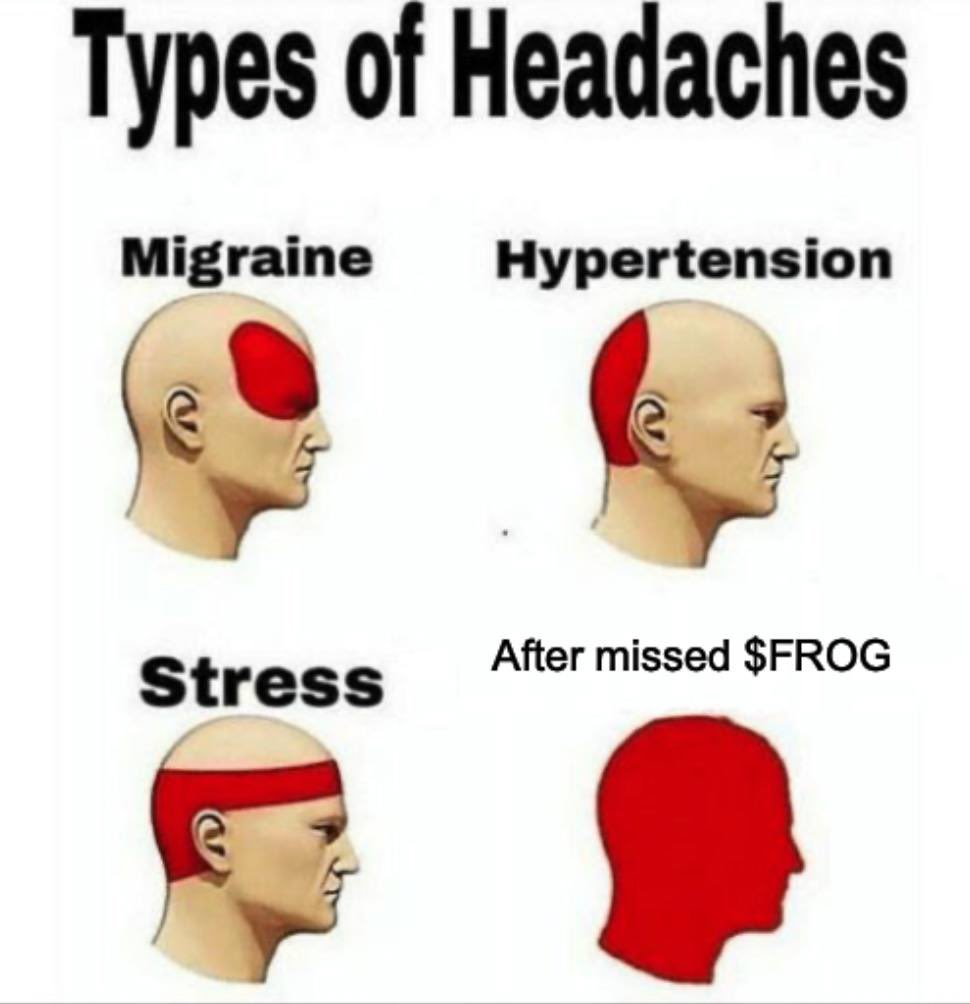 Fyxz_'s tweet photo. @Crouserrr @thisisdjen Gm . If you are having headache, get well soon @FrogCoinSolana  $frog https://t.co/jTnoTwnZrH