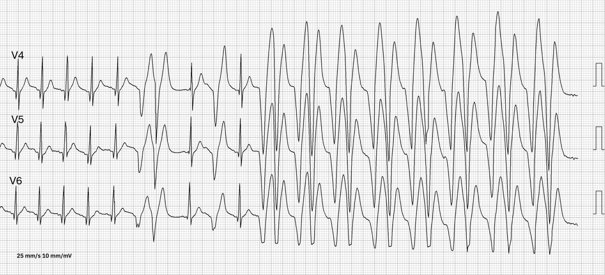 Dr. Andreas Roeschl tweet media