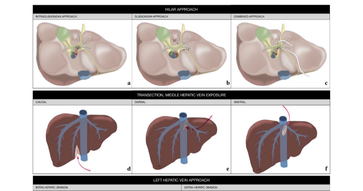 HPB unit Hospital del Mar tweet media