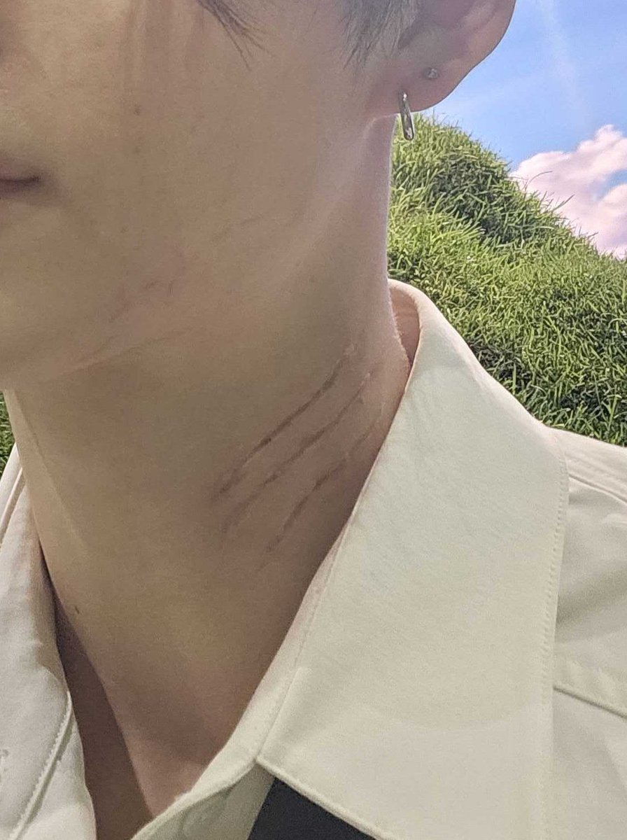 namaewariki's tweet image. the cat scratch mark on his neck 😲