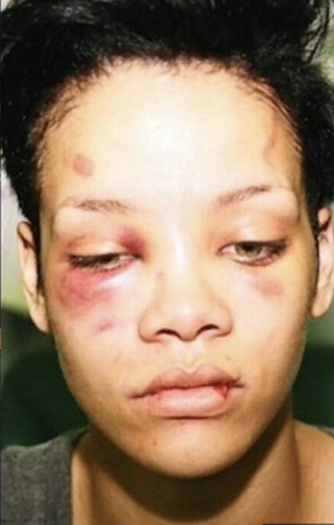 ThatmattersNews's tweet photo. OLYMPICS UPDATE
Rihanna Takes Silver. Chris Brown Wins Gold. https://t.co/CEvlYJD2z1