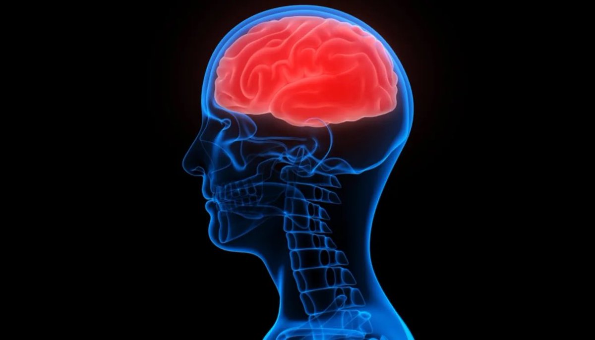 4.USC’nin Glioblastoma Araştırması:
•Glioblastoma, yetişkinlerdeki en ölümcül beyin kanseri, tanıdan sonra hastaların %10’undan azı beş yıl hayatta kalabiliyor.
•AI, glioblastoma hücrelerini antijenleri örnekleyen ve tümörü saldırmak için diğer bağışıklık hücrelerini aktive