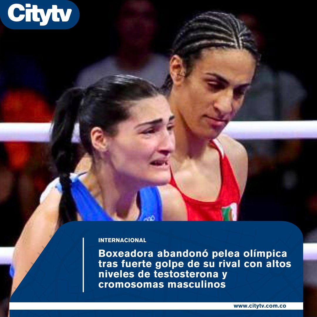 Canal Citytv tweet media