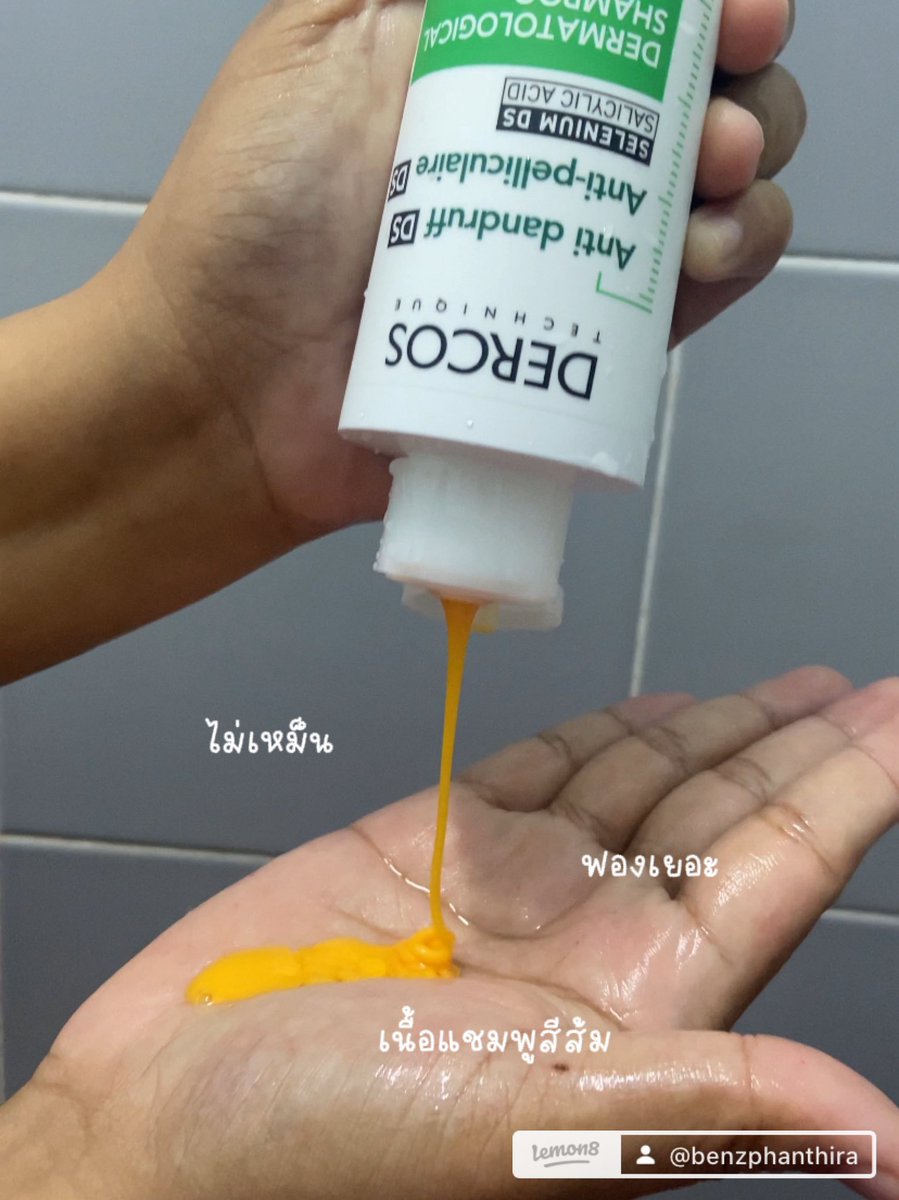 lleehKi's tweet photo. หมดปัญหารังแค หนังหัวลอกเรื่อรัง 🙅‍♀️ 
ใช้แชมพูอะไรก็ไม่หาย เบนซ์เคยใช้มาหลายตัวมาก แต่มาจบที่ตัวนี้ แพทย์แนะนำเลยนะ🧴แชมพูตัวนี้ตัวเดียวเอาอยู่ แพงหน่อย แต่มันดีย์ ✨ #แชมพู #รังแค #ขจัดรังแค #ยาสระผม 

พิกัด https://t.co/fYr1l6r4IZ https://t.co/Tgc3CdAOwD