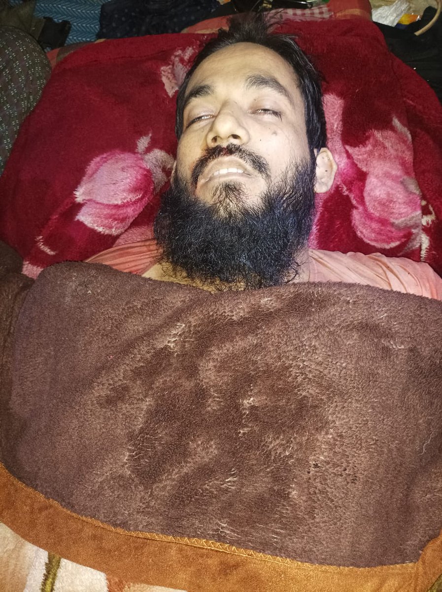 SHOHID IN ARKHAN 🇲🇲

A legend sacrifice his life for Rohingya today 🥺
Mr - Ashadullah has taken his last breath. 
A super hero of the community 👏 
May Allah grant you Highest place in Jannah 
#Amen 
#todaybestphoto #everyone #BestPhotographyChallengeio #RohingyaMuslims hter