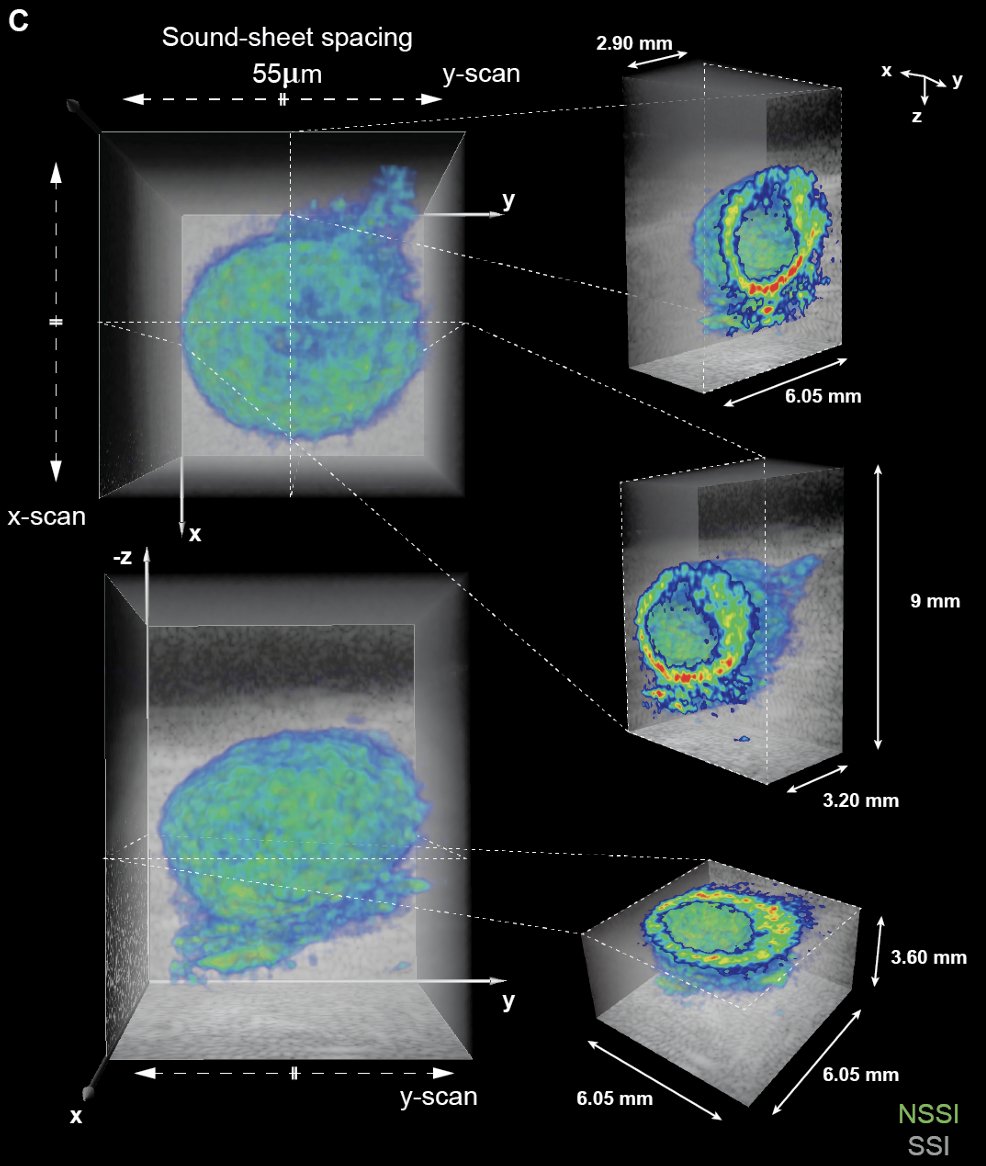 Mikhail Shapiro (same on bsky) ๐บ๐ฆ (@mikhailshapiro) on Twitter photo Sound sheet imaging! ๐Amazing to see acoustic reporter genes in 3D, real time, with high resolution. Congrats to the <a href="/DMarescalab/">David Maresca</a> lab, first author <a href="/bgheiles/">Baptiste Heiles ๐๐ญ๐ง </a> and collaborators. Sound sheet imaging! ๐Amazing to see acoustic reporter genes in 3D, real time, with high resolution. Congrats to the <a href="/DMarescalab/">David Maresca</a> lab, first author <a href="/bgheiles/">Baptiste Heiles ๐๐ญ๐ง </a> and collaborators.