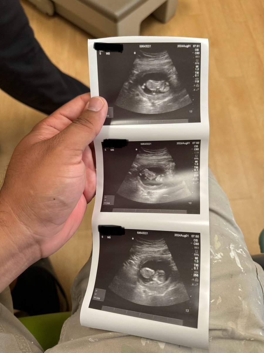 Dice_Ca's tweet photo. I know i been MIA but had to take care of irl things, and one of those things is starting my own family. Happy to announce baby Dice is on their way coming Feb 12,2025 https://t.co/DExJKdNfqJ