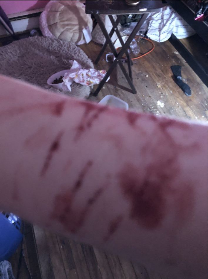 gr3veyard's tweet photo. old pic xd #shtwt i need to learn to cut deeper plz someone give me blade ideas https://t.co/82wt402ZsK