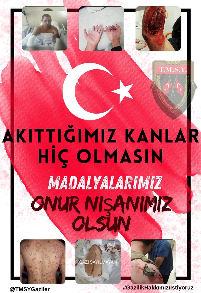 Yusuf870750781's tweet photo. 🇹🇷BAYRAK🇹🇷
KURŞUN YEDİK
MAYIN YEDİK
👇
#GazilikHakkımızıİstiyoruz
☝️
@RTErdogan
@_cevdetyilmaz 
@dbdevletbahceli
@MahinurOzdemir
@deryayanikashb 
@mustafaelitas 
@celebimehmeta
@MvDrHasanArslan
@ifarukaksu 
@UlviYonter
@kocakkonuralp
@SayimMadak
@leventalyyildiz @mhrmkurt, https://t.co/3AnnZ0W4j6
