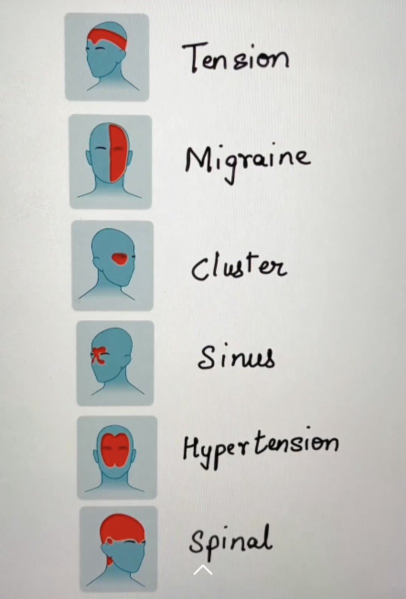 Types of headaches