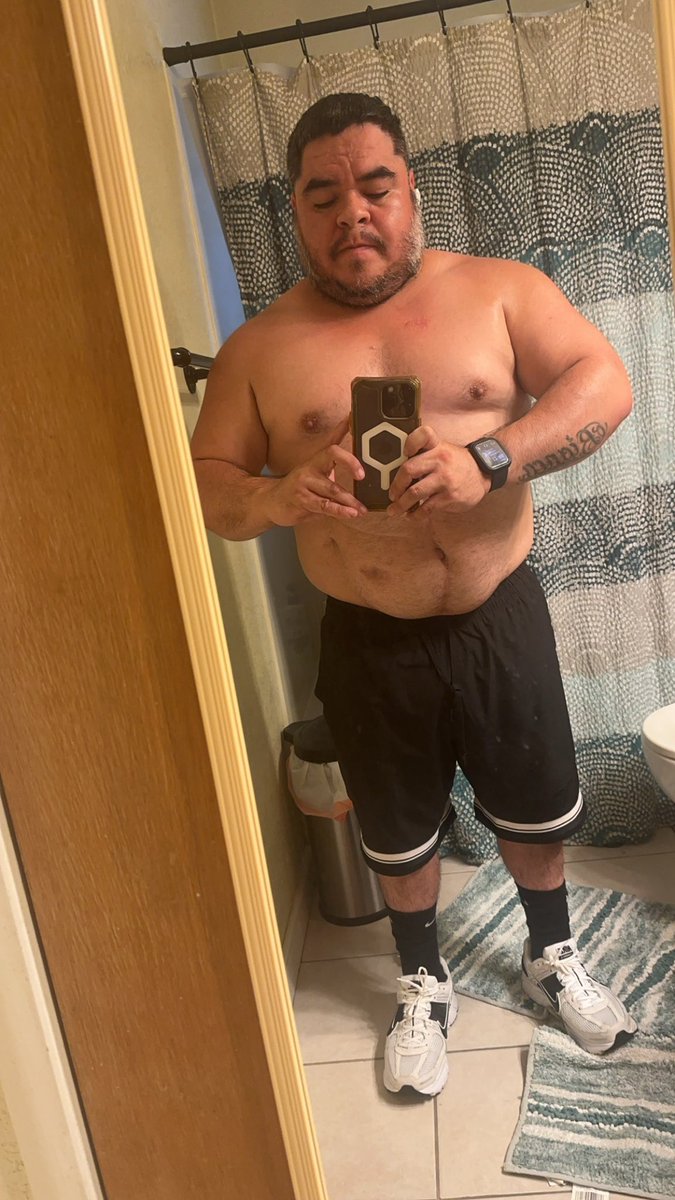Rube510_'s tweet photo. actual first day of light cardio.. the “Rubberband Effect” begins now 🗣️ #BounceBack #OneMonthPostOP https://t.co/XkxlURQQ80