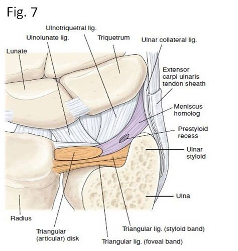 /1 Nice review in March 24 issue of <a href="/PhysioNetwork/">Physio Network</a> by <a href="/iangattphysio/">THE B🥊XING PHYSIO (allabouttheupperlimb🖐️🤛💪)</a> .

"TFCC tear" is one of those well known therefore oft diagnosed injs.

My local hand Doc agrees:
MRI looks like one thing, then a scope finds another.
LT lig tears can masquerade like a TFCC, &amp; ViceVersa.