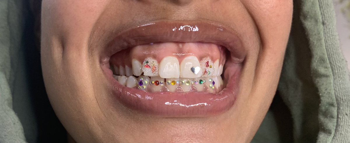 TamiaMelton's tweet photo. TOOTH GEMS (ATL-NYC) #Paris2024 #BBNaijaS9 #Olympics #explore #viral #tiktokhotviral #toothgems #toothwhitening #tiktok https://t.co/vche5uwALZ