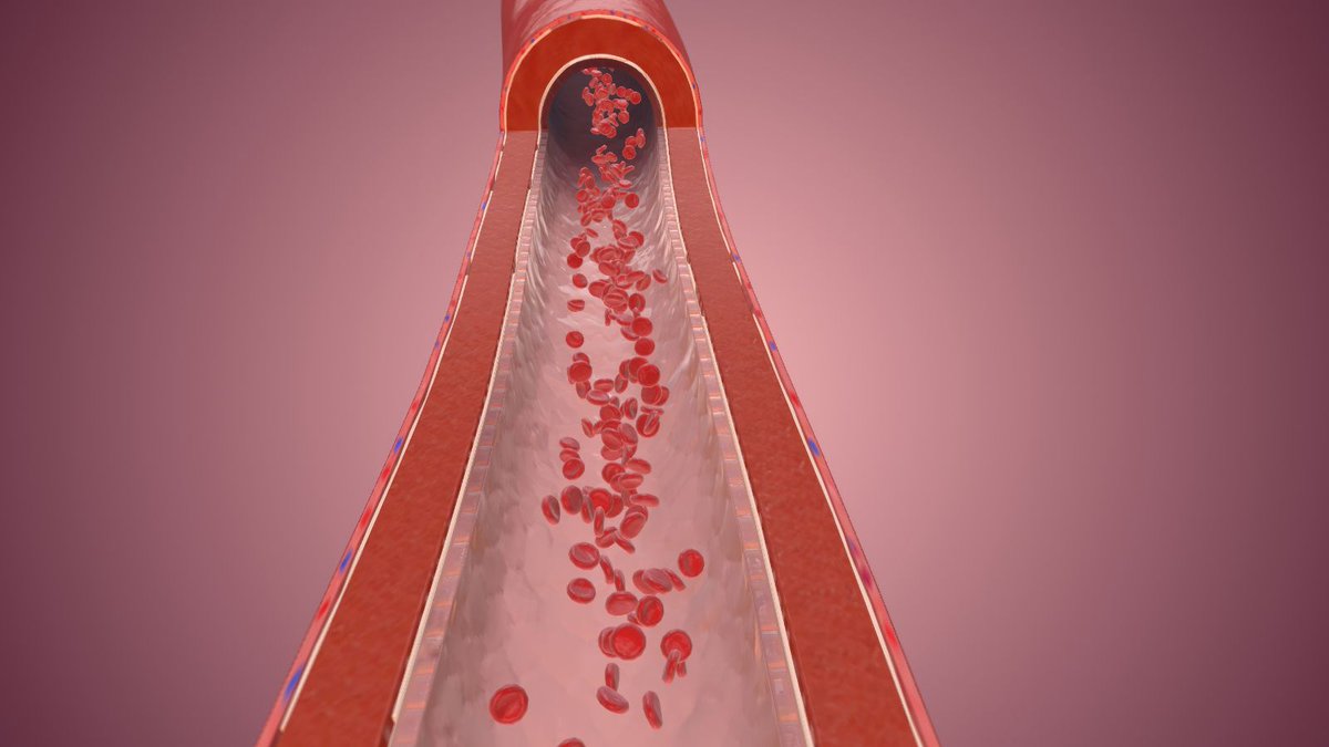 #Hipertensión: si presentas estos síntomas, tu presión arterial está descontrolada ⚠️

cuidateplus.marca.com/bienestar/2024… vía <a href="/CuidatePlus/">CuídatePlus</a>